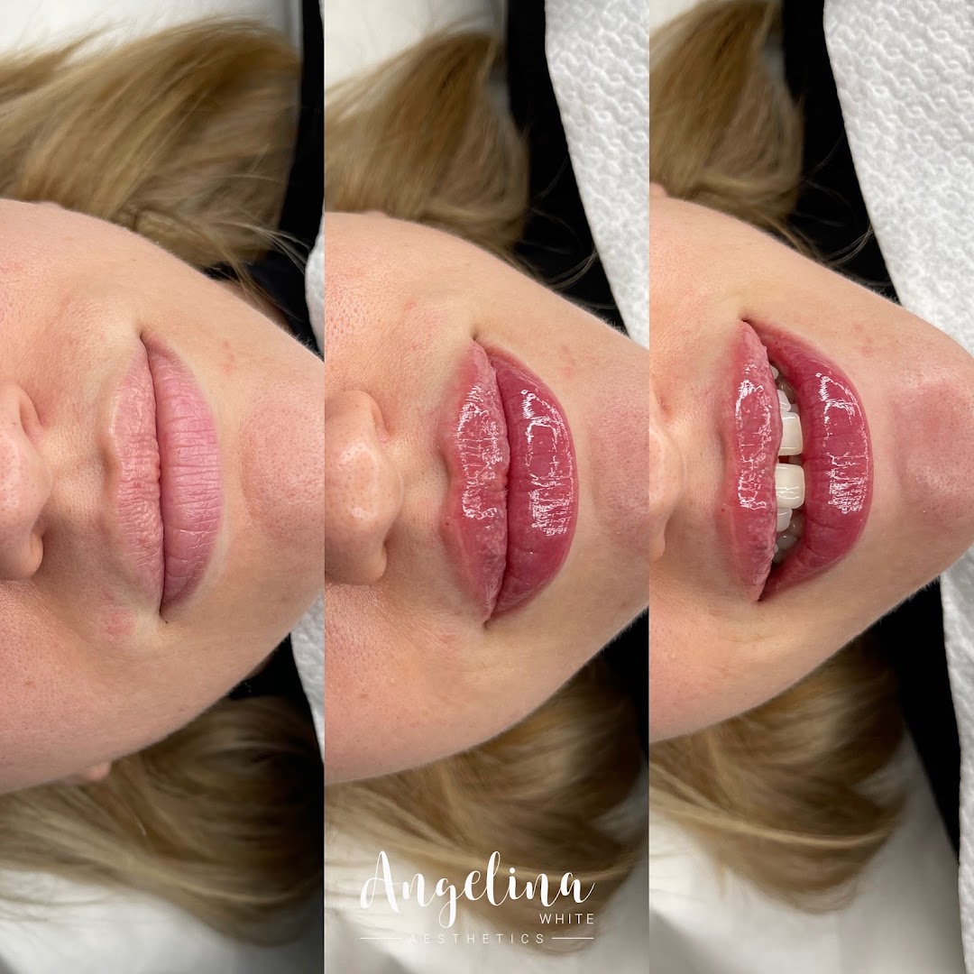Angelina White Aesthetics · Photos 8