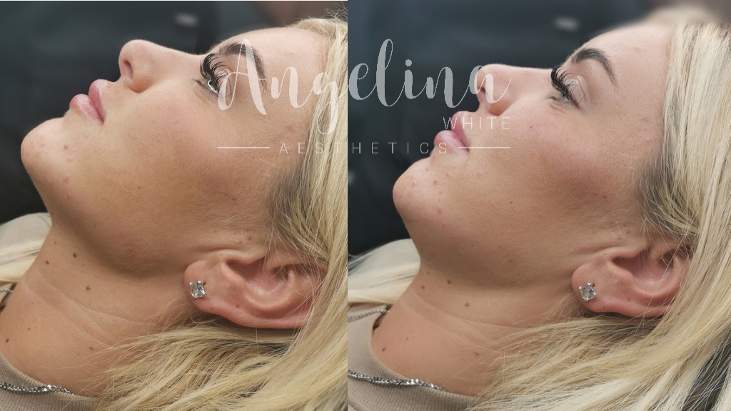 Angelina White Aesthetics · Photos 10
