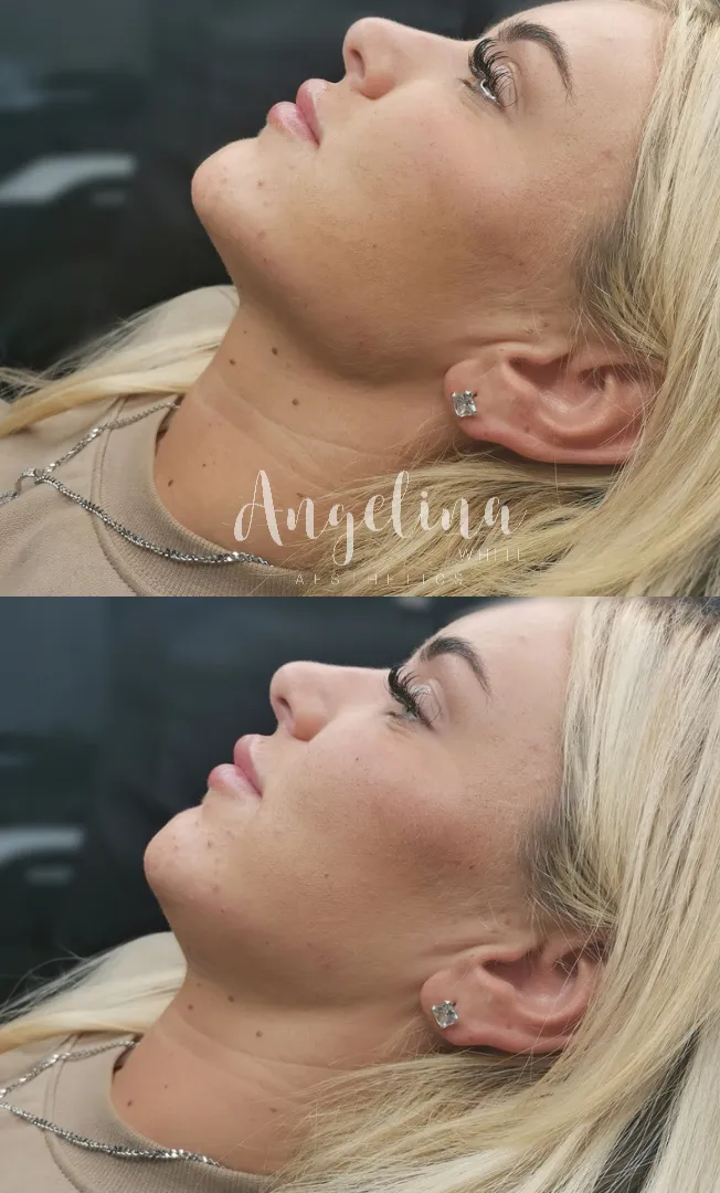 Angelina White Aesthetics · Photos 11